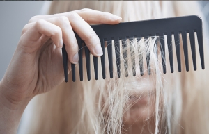 Hair loss in women: causes and help, фото